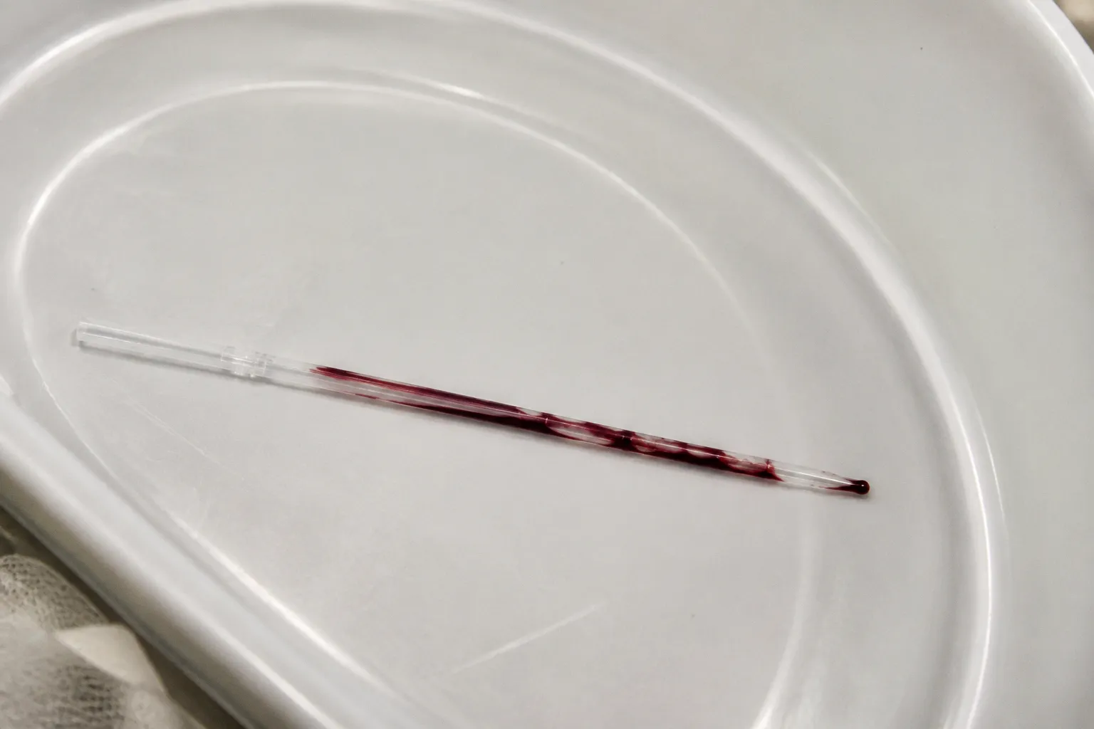 DCE-MRI AIF Calibration: Anatomy of a Failed Endpoint