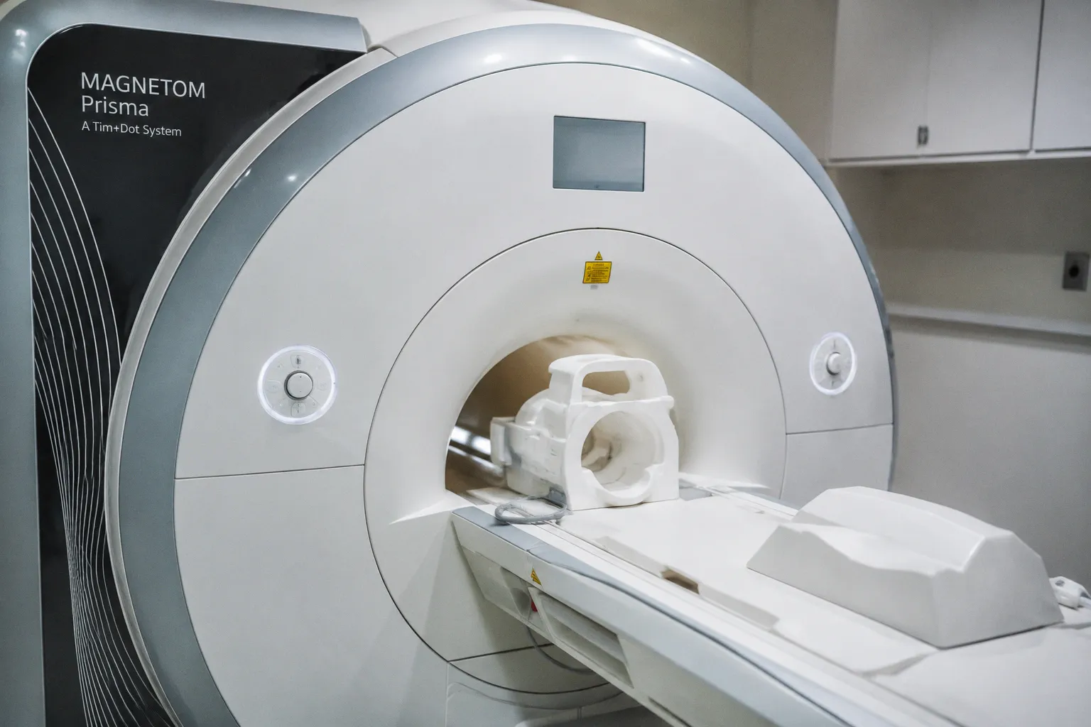 Federated CNN-LSTM Models for Secure and Explainable Stroke Detection in Brain MRI