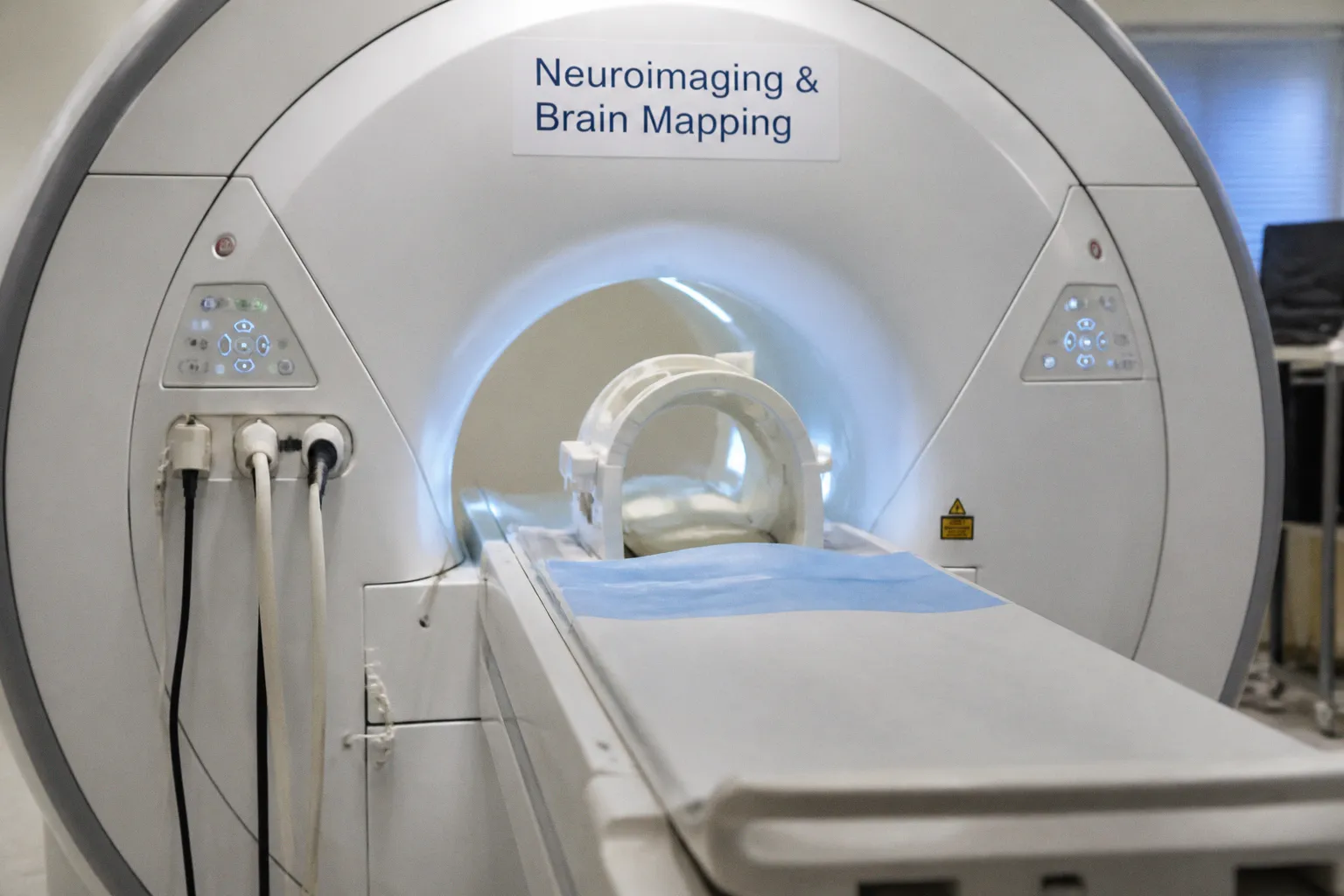 Navigating the Clinical Intersection of ARDS Management and Acute Brain Injury