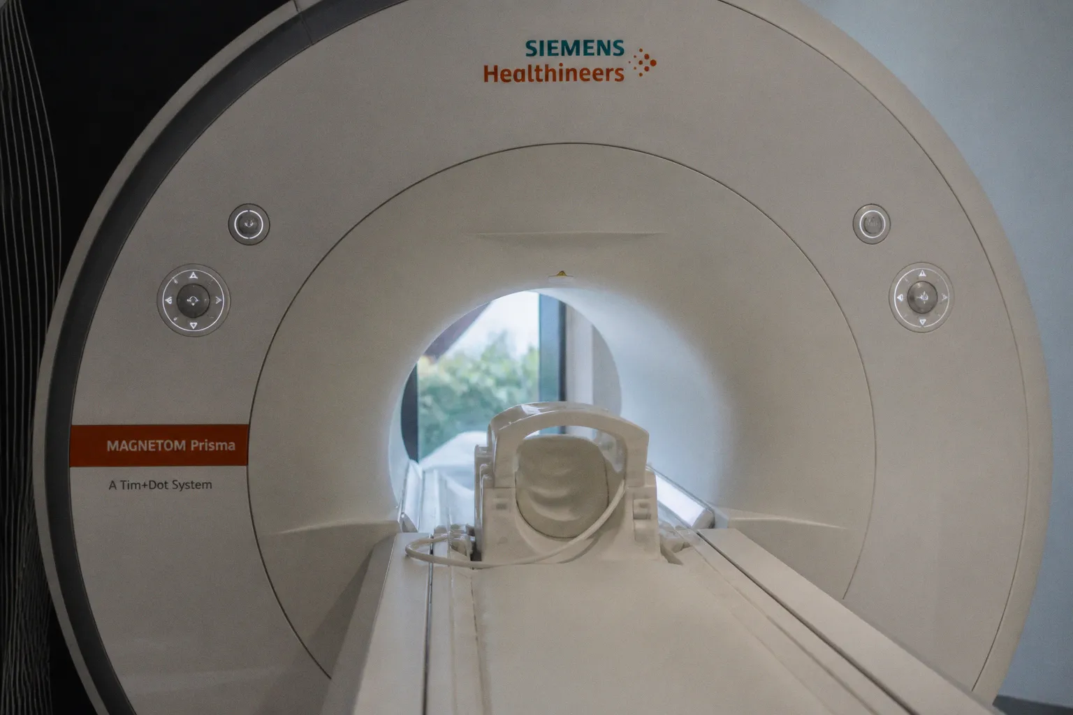 Structural Brain Shifts Detected Seven Years Before Alzheimer’s Amyloid Plaques